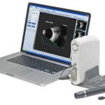 Échographe Occulaire